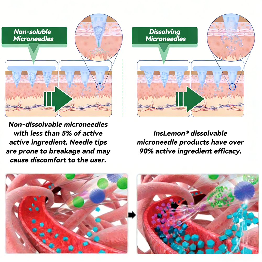 𝐂𝐄 𝐑𝐞𝐠𝐢𝐬𝐭𝐞𝐫𝐞𝐝 & 𝐆𝐌𝐏 𝐂𝐞𝐫𝐭𝐢𝐟𝐢𝐞𝐝 🔬| 𝐈𝐧𝐬𝐋𝐞𝐦𝐨𝐧® 𝑴𝒐𝒓𝒊𝒏𝒈𝒂 & 𝑩𝒆𝒓𝒃𝒆𝒓𝒊𝒏𝒆 𝟏𝟎-𝐈𝐍-𝟏 𝐀𝐝𝐯𝐚𝐧𝐜𝐞𝐝 𝐍𝐚𝐧𝐨 𝐌𝐢𝐜𝐫𝐨𝐧𝐞𝐞𝐝𝐥𝐞 𝐏𝐚𝐭𝐜𝐡 | ✅ 𝐁𝐚𝐜𝐤𝐞𝐝 𝐛𝐲 𝐒𝐜𝐢𝐞𝐧𝐭𝐢𝐟𝐢𝐜 𝐄𝐯𝐢𝐝𝐞𝐧𝐜𝐞 | 𝟏𝟎-𝐢𝐧-𝟏 𝐅𝐨𝐫𝐦𝐮𝐥𝐚 | 𝐑𝐞𝐬𝐮𝐥𝐭𝐬 𝐢𝐧 𝟓 𝐃𝐚𝐲𝐬