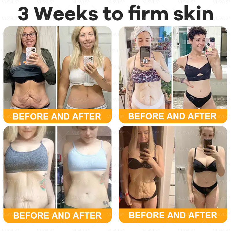 Made and Shipped from Canada ✨ 𝙑𝙇𝙎𝙑𝙇𝙎® Bee 𝙑𝙚𝙣𝙤𝙢 𝘾𝙤𝙢𝙥𝙧𝙚𝙝𝙚𝙣𝙨𝙞𝙫𝙚 𝘾𝙧𝙚𝙖𝙢 (Suitable for use byindividuals of all ages & Dermatologist recommends)⏰ LAST DAY 80% OFF