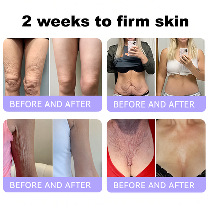 Himilk® Bee Venom & Botox Wrinkle-Lift Tightening Cream 🐝 (Anti-Aging,Hydration, Skin Repair, Acne & Dark Spot Treatment, Wart & Mole Removal, Psoriasis Relief) 🌸- Formulated in Canada